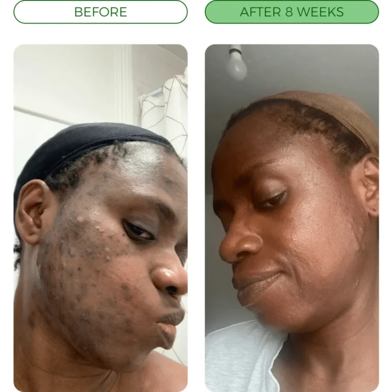 before-after_3_1_b65f133d-7f73-4d52-b5c9-3c15577d3a70-1024x1024-1.webp
